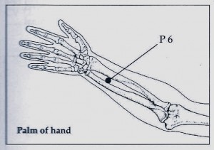 P 6 Acupressure Point P 6 "Inner Gate"